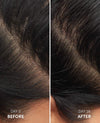 Before and after comparison of hair growth on a person's scalp, showing visible difference over 28 days.