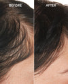 Before and after comparison of hair growth on a person's scalp.